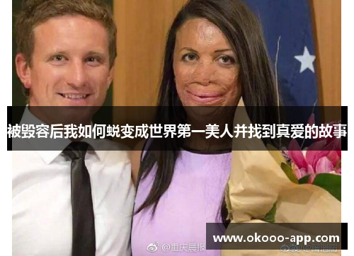 被毁容后我如何蜕变成世界第一美人并找到真爱的故事